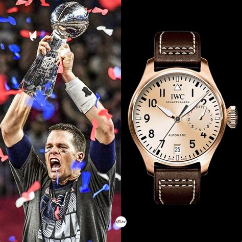 tom brady watch collection.